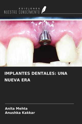 IMPLANTES DENTALES: UNA NUEVA ERA