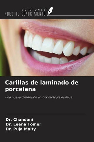 Carillas de laminado de porcelana