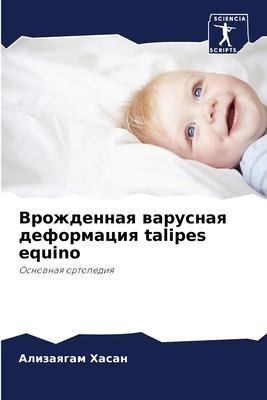 Vrozhdennaq warusnaq deformaciq talipes equino