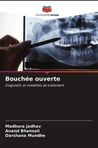 Bouchée ouverte