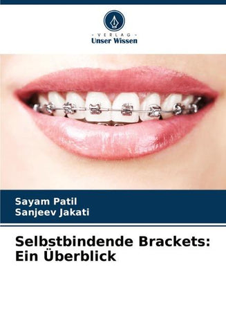 Selbstbindende Brackets: Ein Überblick