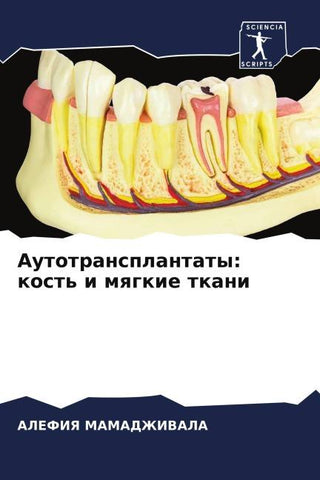 Autotransplantaty: kost' i mqgkie tkani