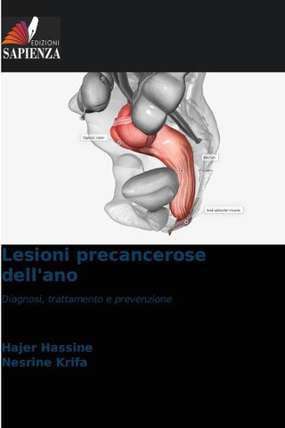 Lesioni precancerose dell'ano
