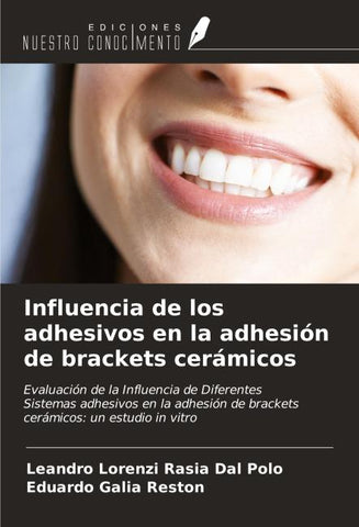 Influencia de los adhesivos en la adhesión de brackets cerámicos