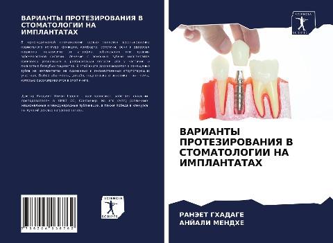 VARIANTY PROTEZIROVANIYa V STOMATOLOGII NA IMPLANTATAH