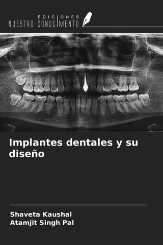 Implantes dentales y su diseño
