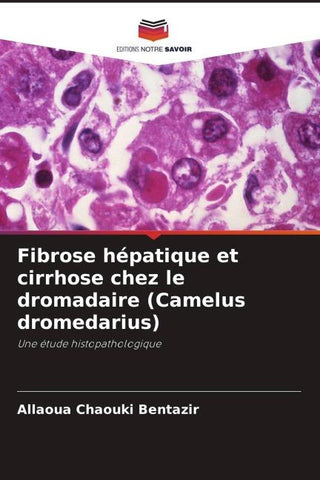 Fibrose hépatique et cirrhose chez le dromadaire (Camelus dromedarius)
