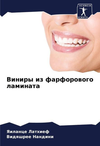 Viniry iz farforowogo laminata