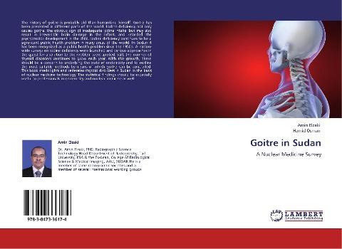 Goitre in Sudan