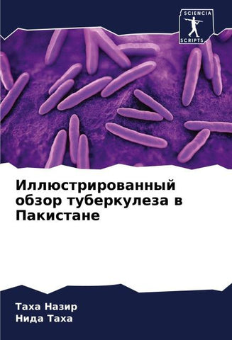 Illüstrirowannyj obzor tuberkuleza w Pakistane
