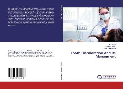 Tooth Discoloration And Its Managment