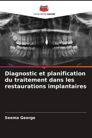 Diagnostic et planification du traitement dans les restaurations implantaires