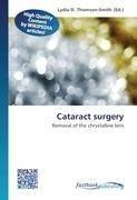 Cataract surgery