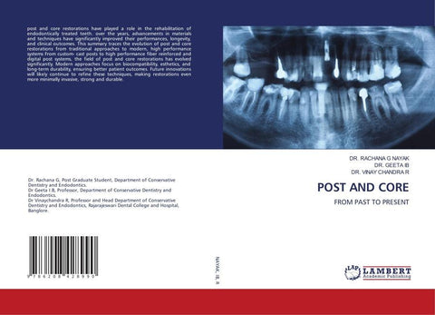 POST AND CORE