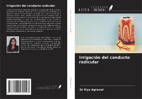 Irrigación del conducto radicular