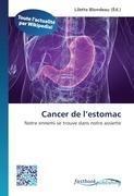 Cancer de l'estomac