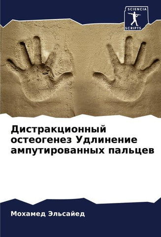 Distrakcionnyj osteogenez Udlinenie amputirowannyh pal'cew