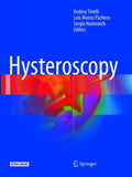 Hysteroscopy