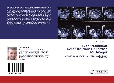 Super-resolution Reconstruction Of Cardiac MR Images