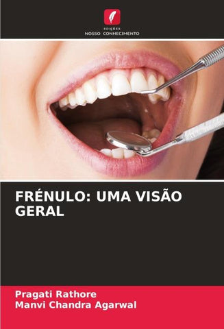 FRÉNULO: UMA VISÃO GERAL