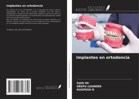 Implantes en ortodoncia
