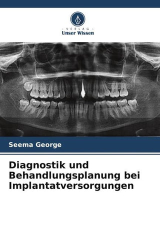 Diagnostik und Behandlungsplanung bei Implantatversorgungen