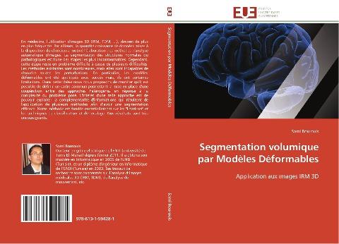 Segmentation volumique par Modèles Déformables
