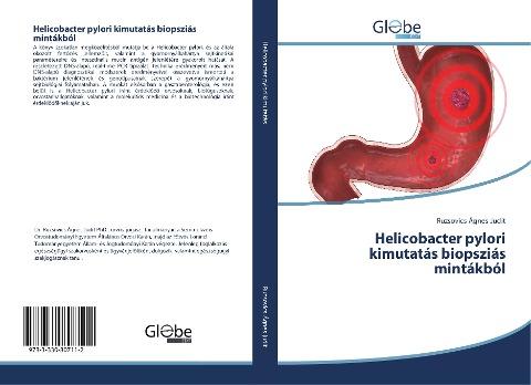 Helicobacter pylori kimutatás biopsziás mintákból