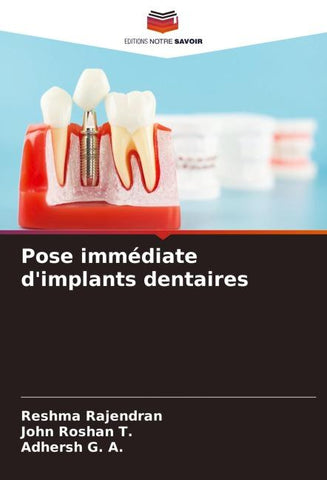 Pose immédiate d'implants dentaires