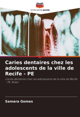 Caries dentaires chez les adolescents de la ville de Recife - PE