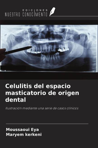 Celulitis del espacio masticatorio de origen dental