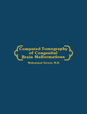 Computed Tomography of Congenital Brain Malformations