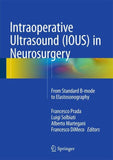 Intraoperative Ultrasound (IOUS) in Neurosurgery
