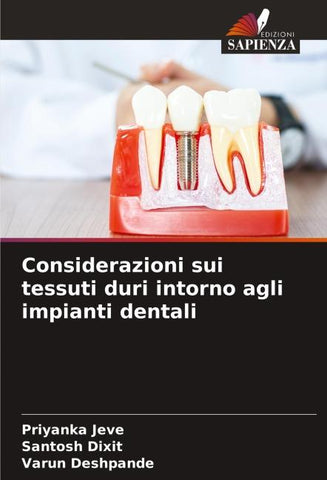 Considerazioni sui tessuti duri intorno agli impianti dentali