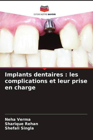 Implants dentaires : les complications et leur prise en charge