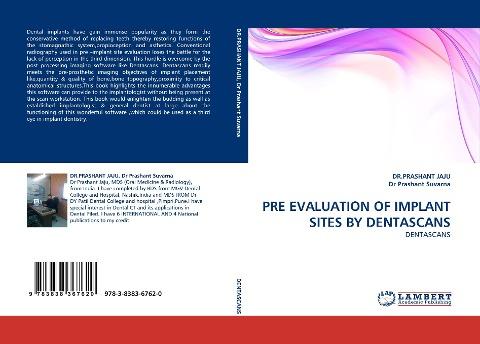 PRE EVALUATION OF IMPLANT SITES BY DENTASCANS