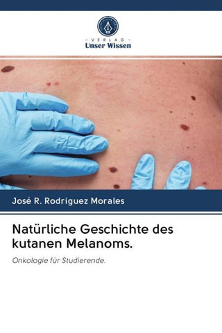 Natürliche Geschichte des kutanen Melanoms.