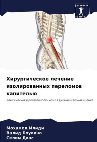 Hirurgicheskoe lechenie izolirowannyh perelomow kapitel'ü