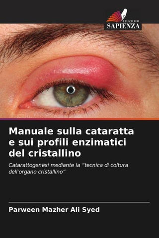 Manuale sulla cataratta e sui profili enzimatici del cristallino