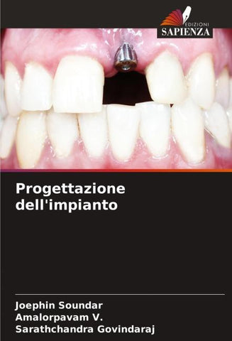 Progettazione dell'impianto