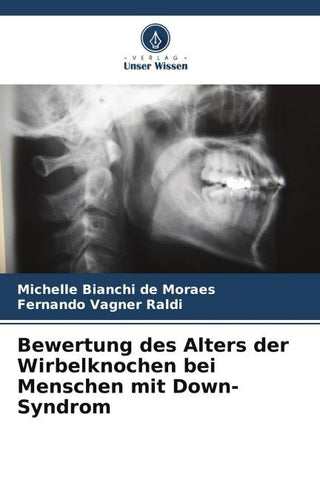 Bewertung des Alters der Wirbelknochen bei Menschen mit Down-Syndrom