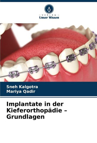 Implantate in der Kieferorthopädie - Grundlagen