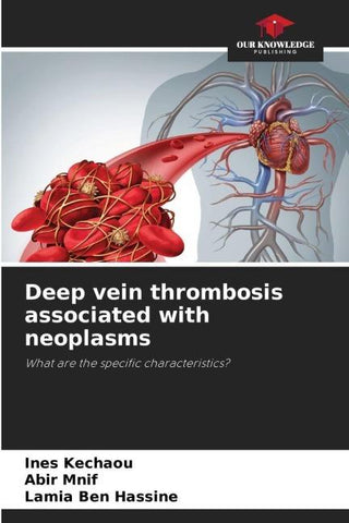Deep vein thrombosis associated with neoplasms