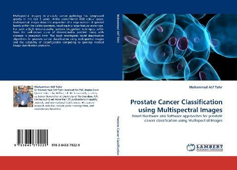 Prostate Cancer Classification using Multispectral Images