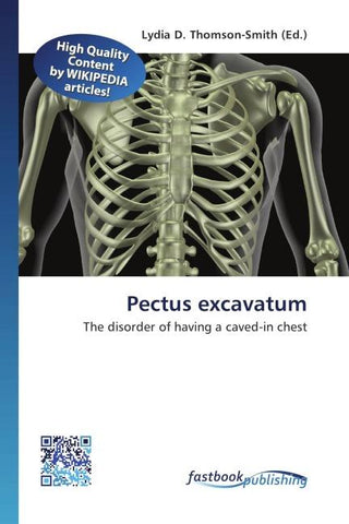 Pectus excavatum