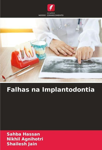 Falhas na Implantodontia