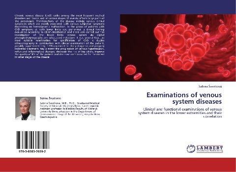 Examinations of venous system diseases