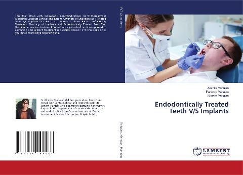 Endodontically Treated Teeth V/S Implants