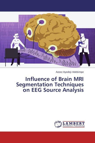 Influence of Brain MRI Segmentation Techniques on EEG Source Analysis