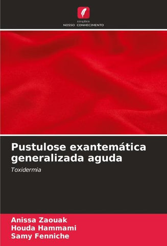 Pustulose exantemática generalizada aguda